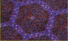 Sample Medical Animation